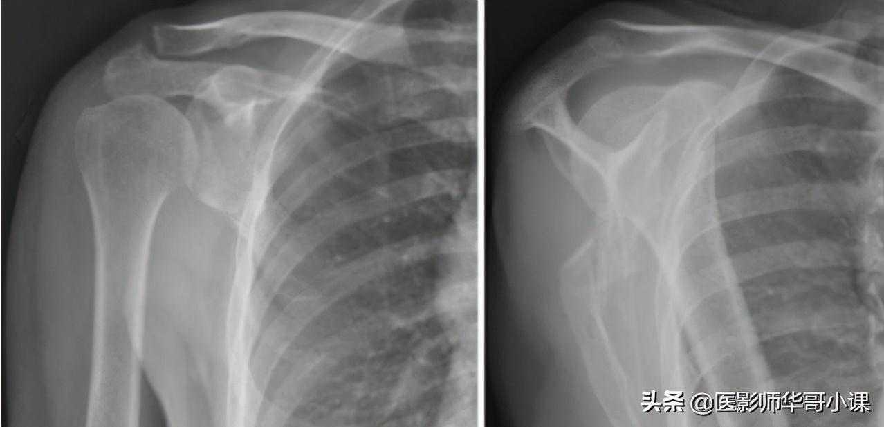 骨关节记忆要点，请收藏